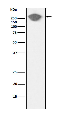 Fibronectin Rabbit mAb