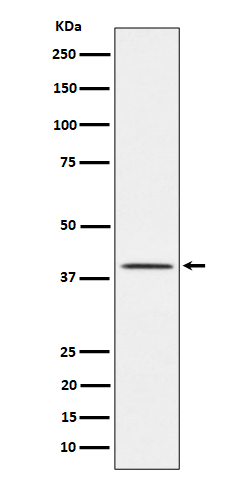 TTF1 Rabbit mAb