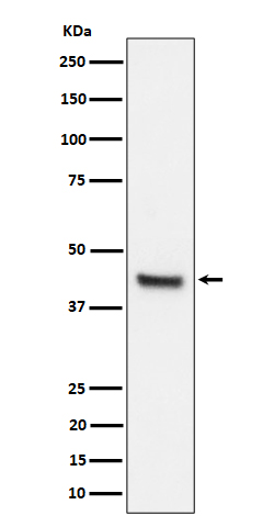 IL11RA Rabbit mAb