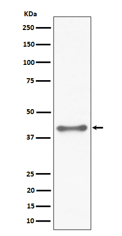 TTF1 Rabbit mAb