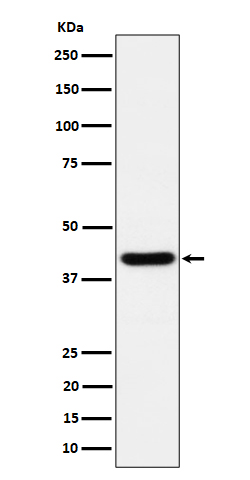 Spermine synthase Rabbit mAb