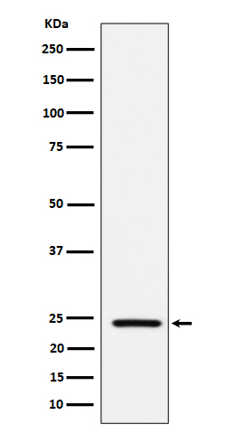 SOD2 (acetyl K68) Rabbit mAb