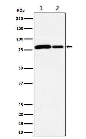 MMUT Rabbit mAb