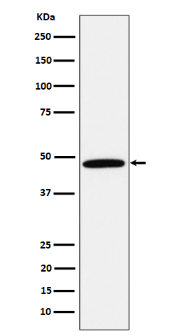 Calumenin Rabbit mAb