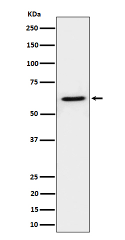 IKZF3 Rabbit mAb