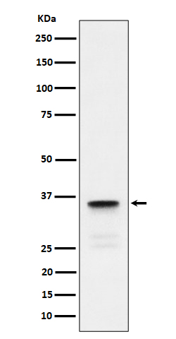 Lactate Dehydrogenase C Rabbit mAb