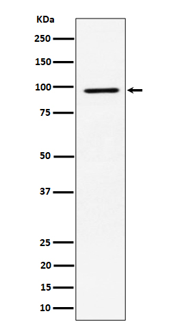 RSK2 / RPS6KA3 Rabbit mAb