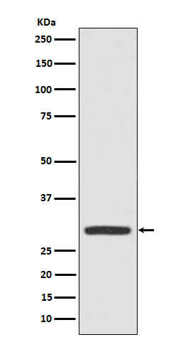 Galectin 3 Rabbit mAb