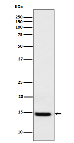 Galectin 1