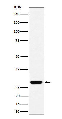 GCLM Rabbit mAb