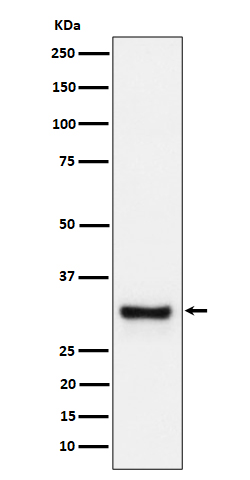 Adiponectin Rabbit mAb