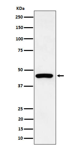 Cytokeratin 19 Rabbit mAb