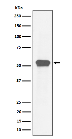 MEF2A Rabbit mAb