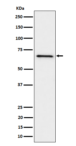 GRK6 Rabbit mAb