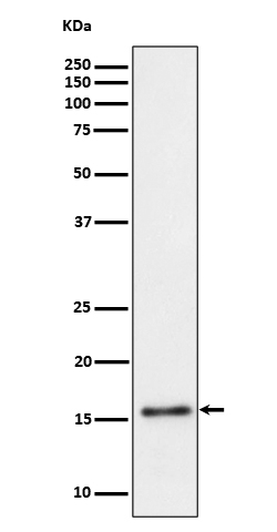 TRAPPC2 Rabbit mAb