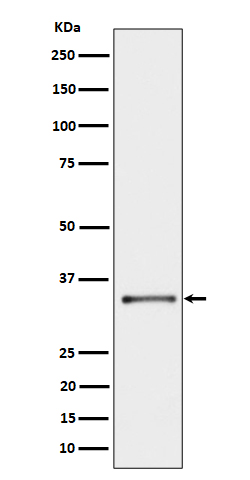 CYB5R3 Rabbit mAb