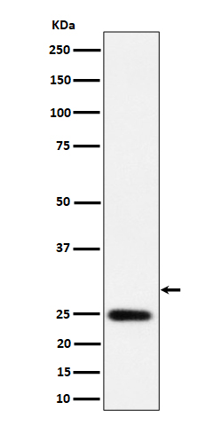 NAT1 Rabbit mAb