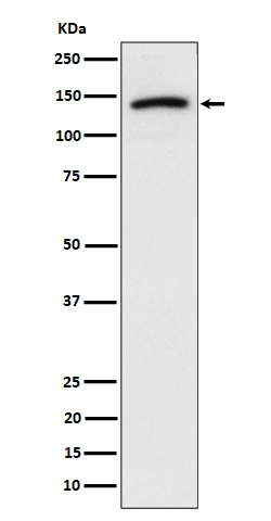 Cadherin 10 Rabbit mAb