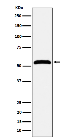 MPP1 Rabbit mAb