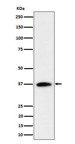 RASSF2 Rabbit mAb