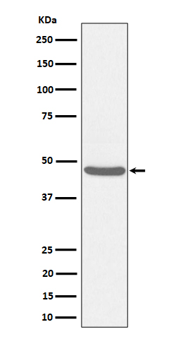 BCKDK Rabbit mAb