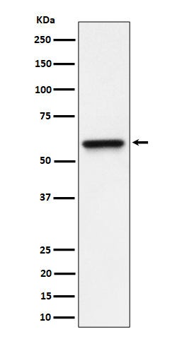 RGS6 Rabbit mAb