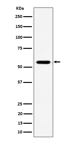 RNF14 Rabbit mAb