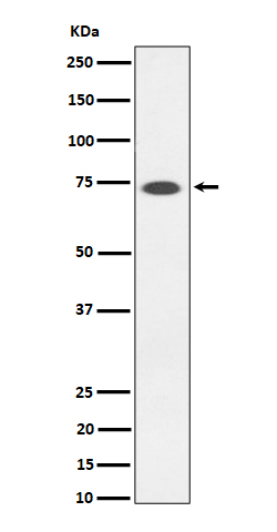 SSTR3  Rabbit mAb