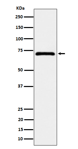 EPHX2 Rabbit mAb