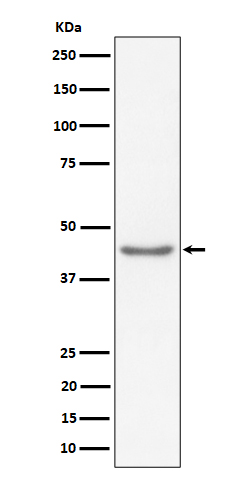 RBMXL2 Rabbit mAb