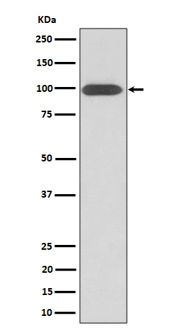 Integrin beta 3 / CD61 Rabbit mAb