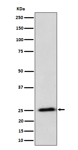 RPL10A Rabbit mAb