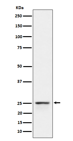 PEX11B Rabbit mAb