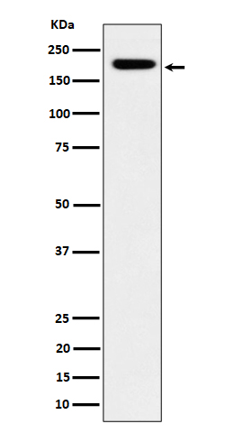 IQGAP2 Rabbit mAb