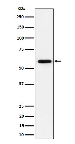 PRPF31 Rabbit mAb