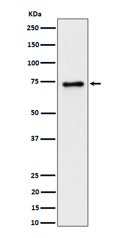 PTPRR Rabbit mAb