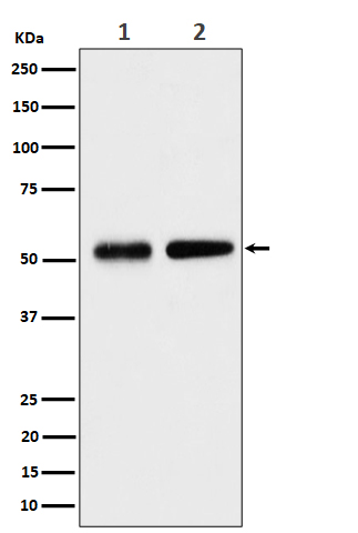 Septin 8 Rabbit mAb