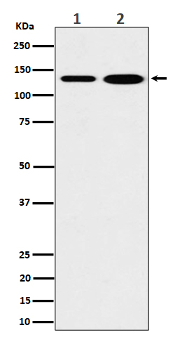 MYO1B Rabbit mAb