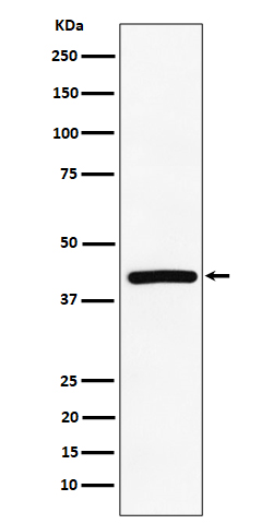 TMEM43 Rabbit mAb