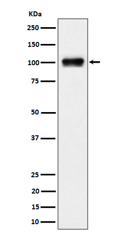 Nesprin3 Rabbit mAb