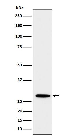 PSMB10 Rabbit mAb