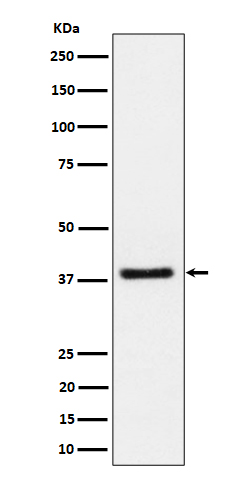 UCHL5IP Rabbit mAb