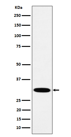 HMGCL Rabbit mAb