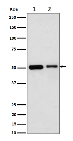 Annexin A7 Rabbit mAb