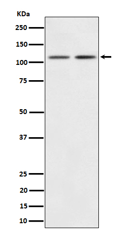 PI3 Kinase p110 beta Rabbit mAb