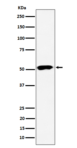 PPP2R5E Rabbit mAb