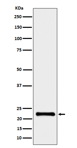 CRCP Rabbit mAb