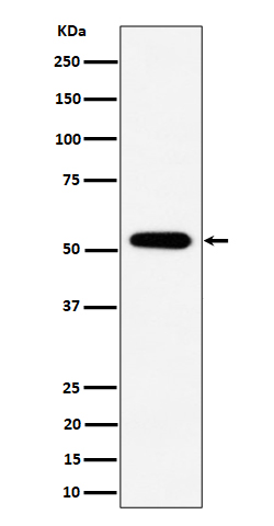 PPP2R5E Rabbit mAb