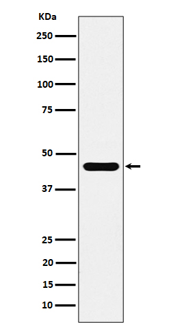 ACTR1B Rabbit mAb