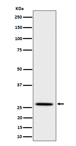 Adiponectin Rabbit mAb